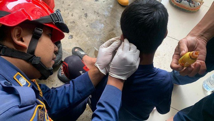Tragis! Bocah di Bogor Tertusuk Kail Pancing di Telinga, Butuh Pertolongan Darurat