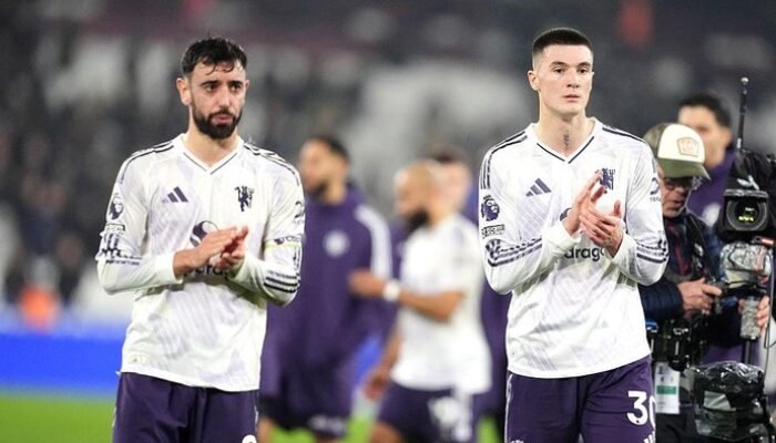 MU Kembali Dihinggapi Skandal Cukur Frank Ilett, Duh!