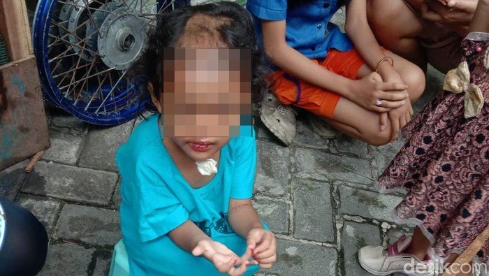 Paman dan Bibi di Surabaya Dianiaya Balita: Kisah Sedih yang Menuntut Perhatian